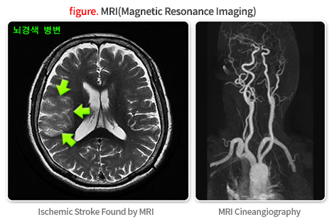 figure. MRI