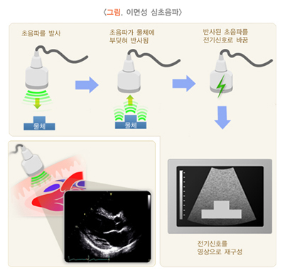 firgure.Dimensional (2D) Echocardiography