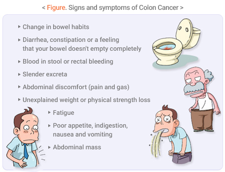 Signs and symptoms of Colon Cancer