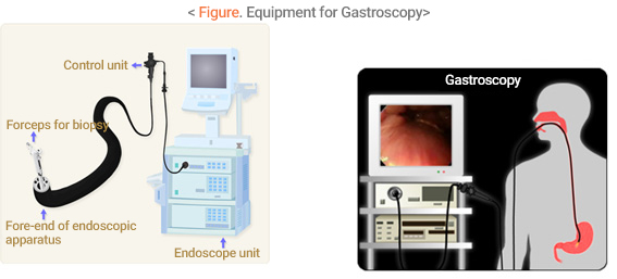 Figure. Equipment for Gastroscopy